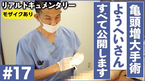 亀頭増大 写真|【症例写真】亀頭増大術の症例一覧 ： 美容整形の高須クリニック